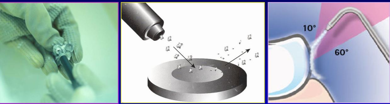 <p>what is airborne particle abrasion </p>