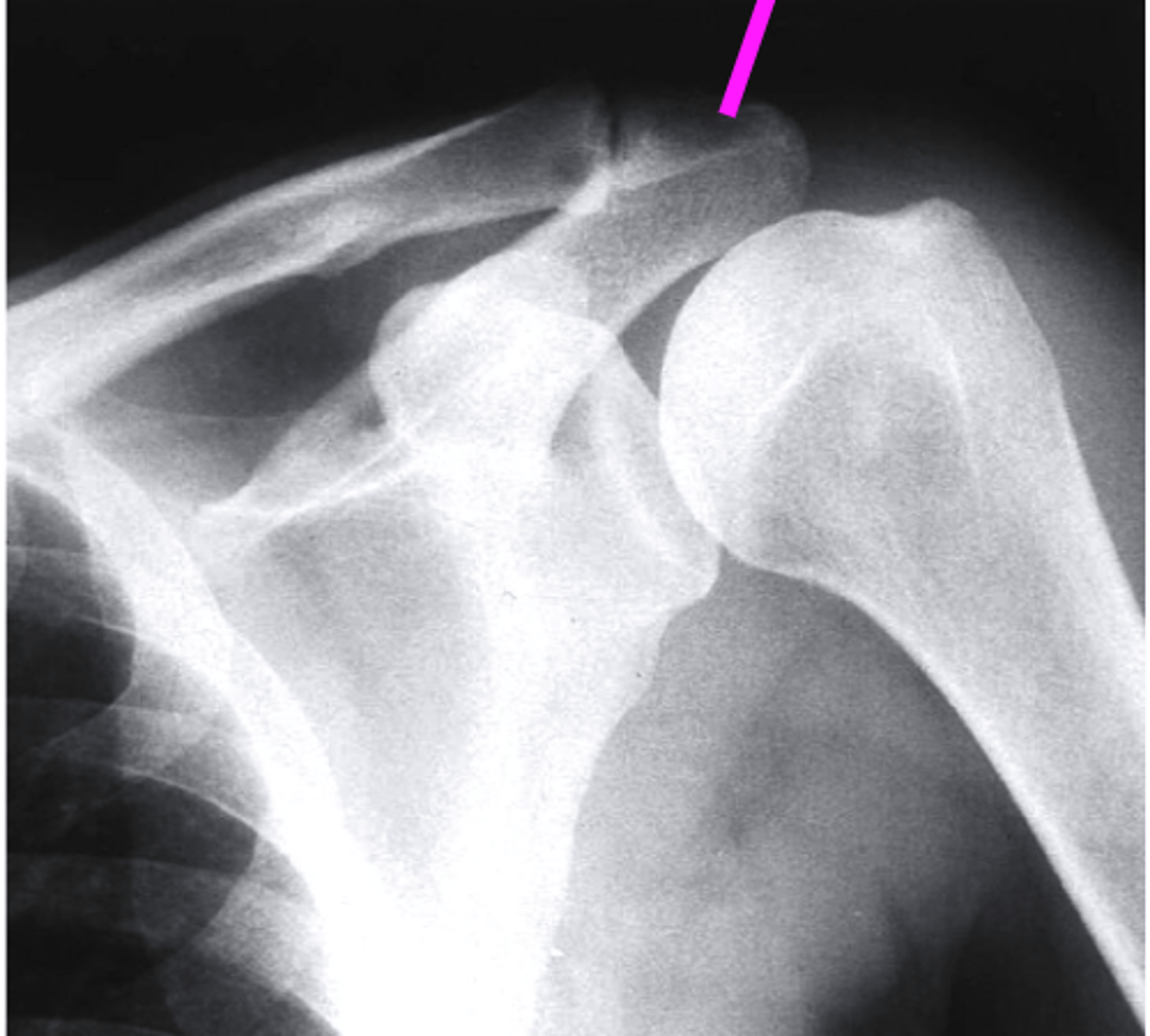 <p>what does the pink line point to?</p>