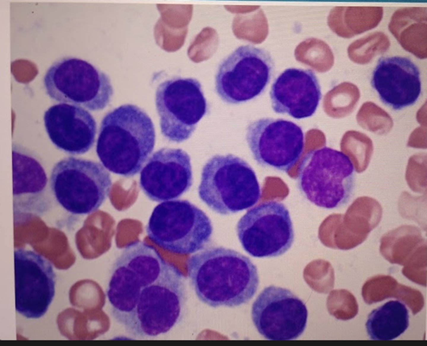<p>Increased plasma calls</p>