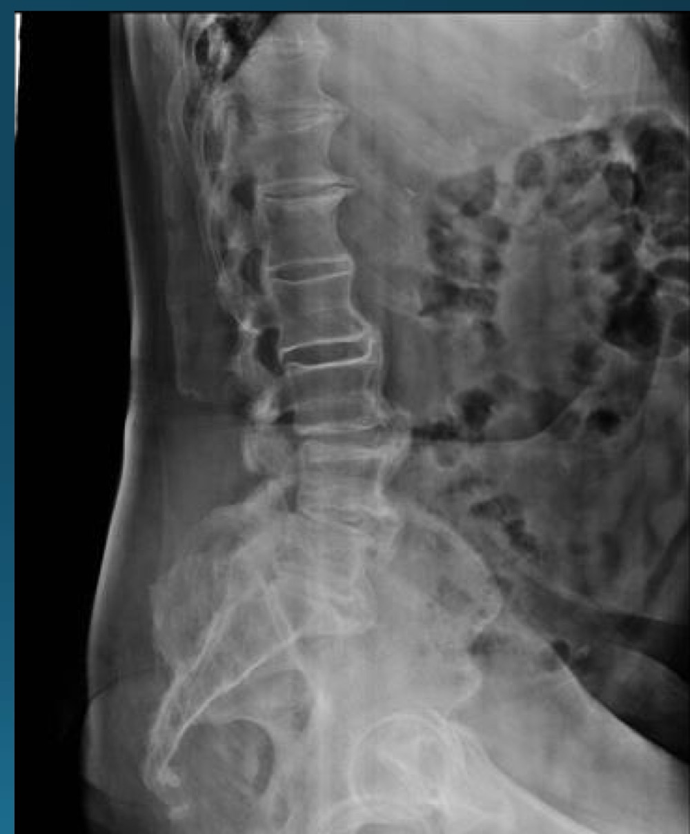 <p>what are the findings in this image? </p>