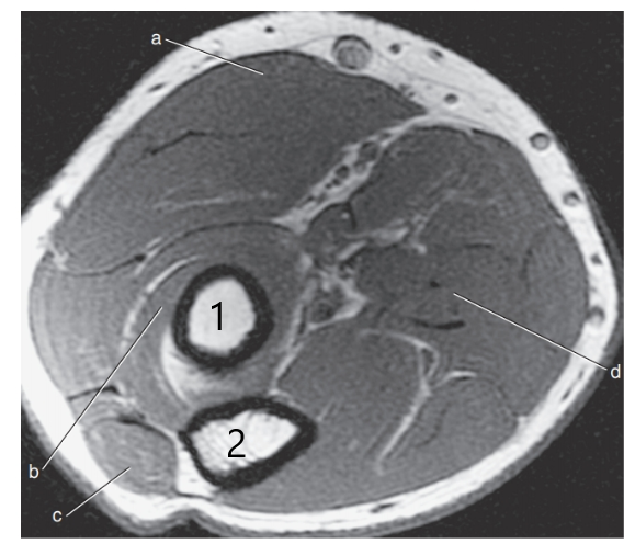<p>What anatomy is # 2 ?</p>