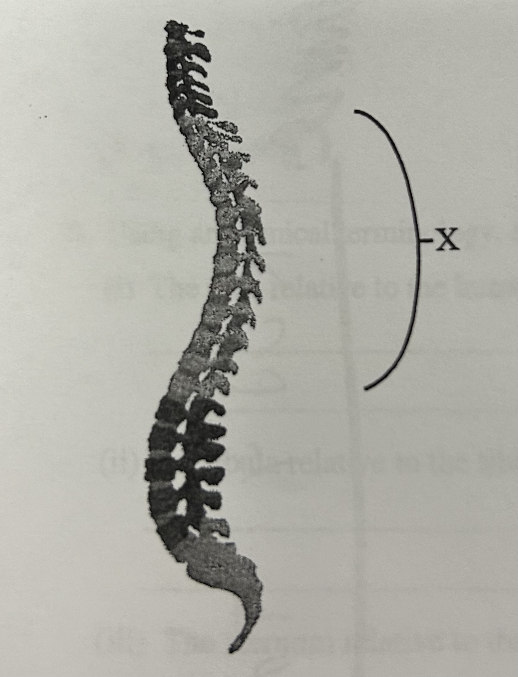 <p>Which area of the vertebral column is labelled X in the diagram?</p>