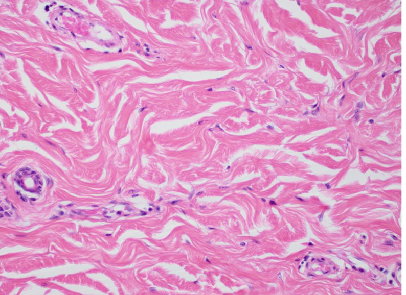 <p>what tissue is this </p>