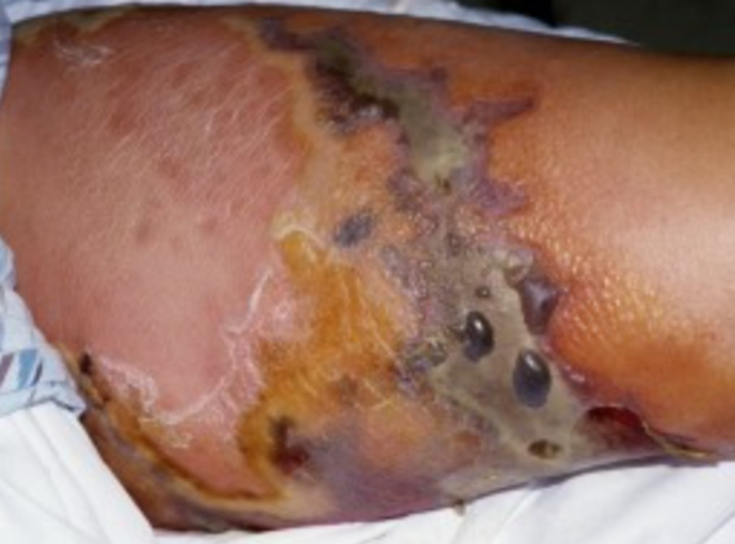 <p>What is the diagnosis?</p>