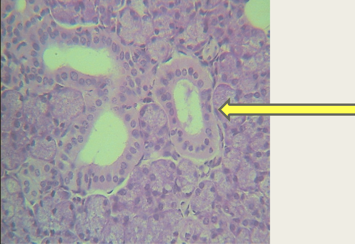 <p>Identify the structure&nbsp;</p>