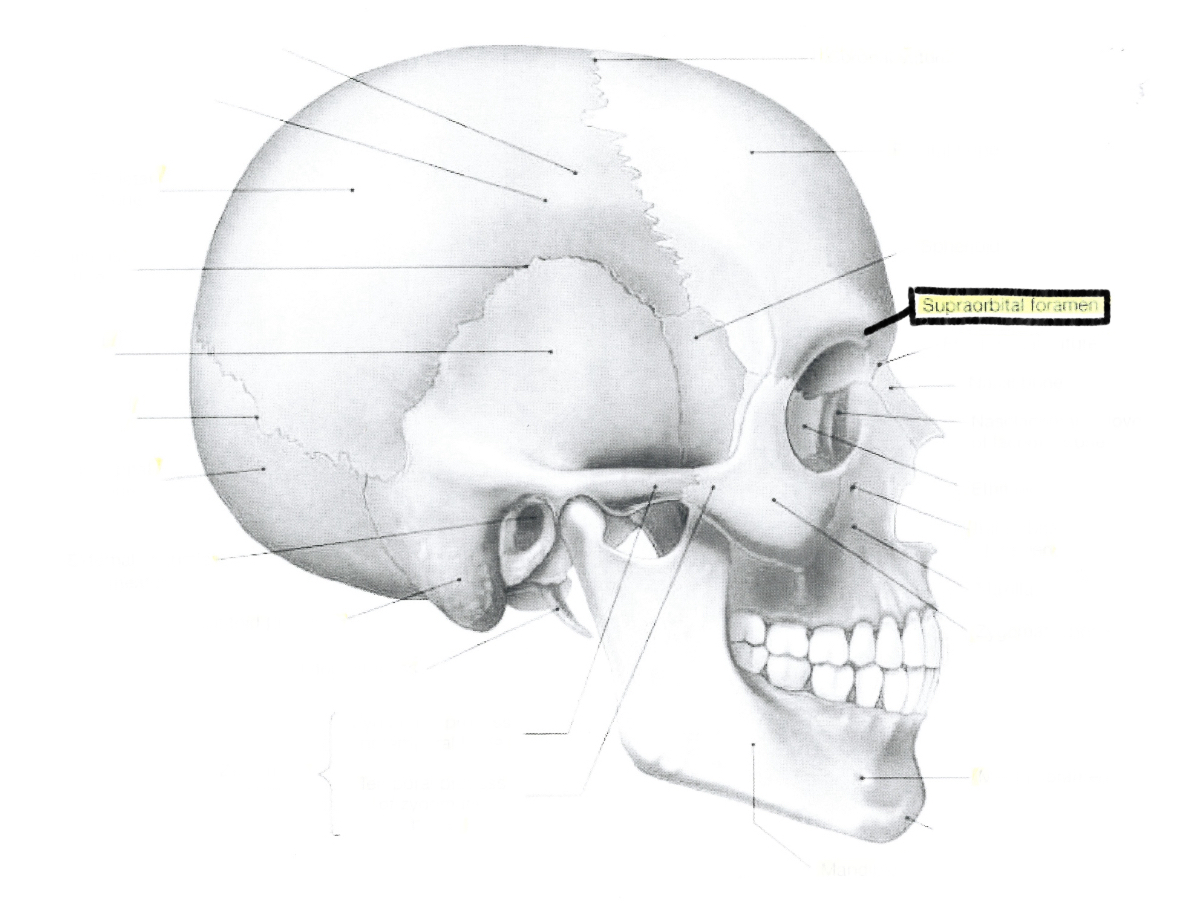 <p>Supraorbital foramen</p>