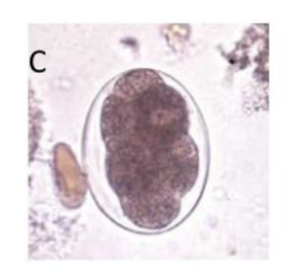 <p>What parasite does this egg belong to?</p>