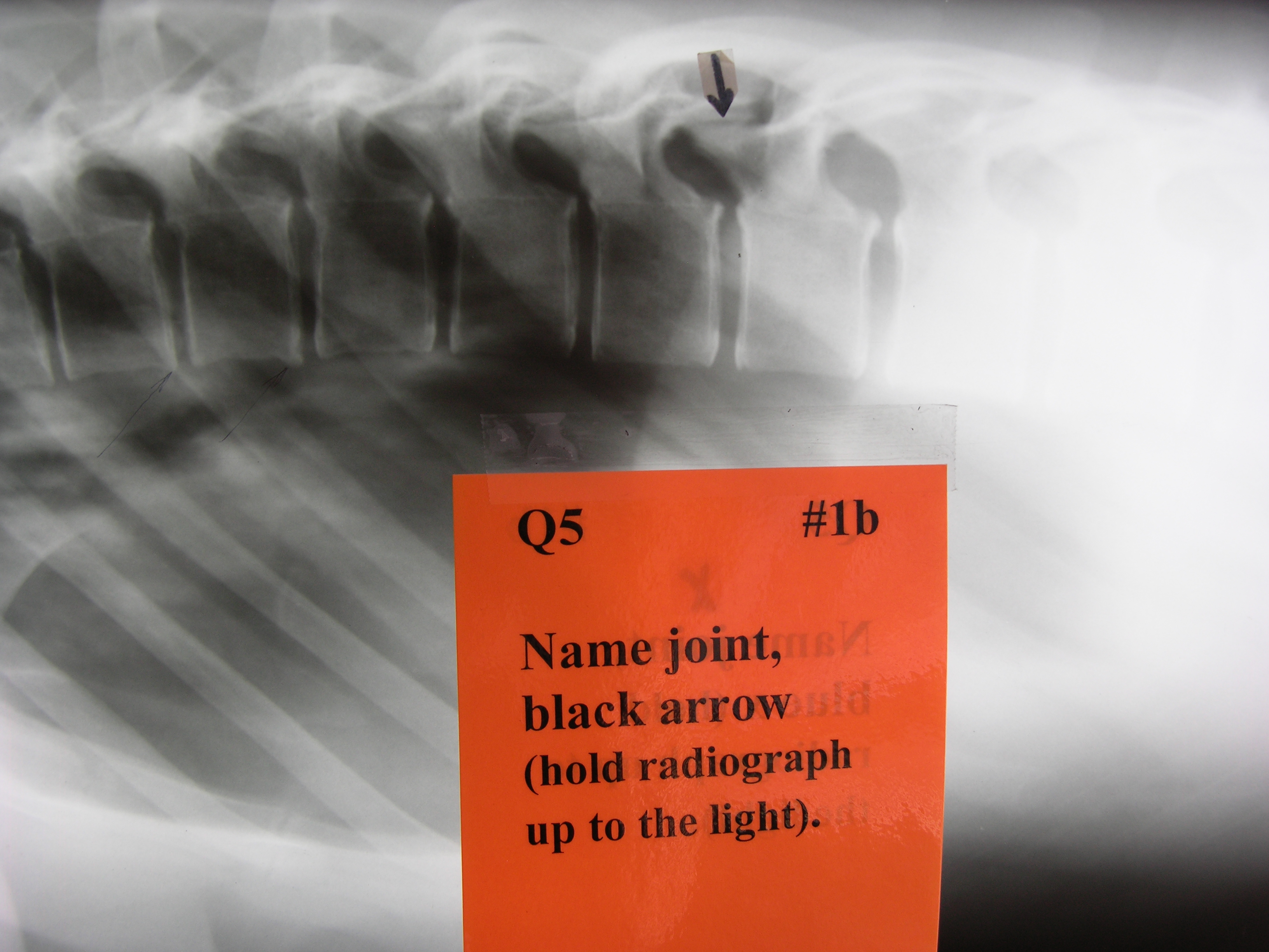 <p><span style="font-family: Lato Extended, Lato, Helvetica Neue, Helvetica, Arial, sans-serif; color: rgb(45, 59, 69)">Name the joint indicated by the black arrow.</span></p>