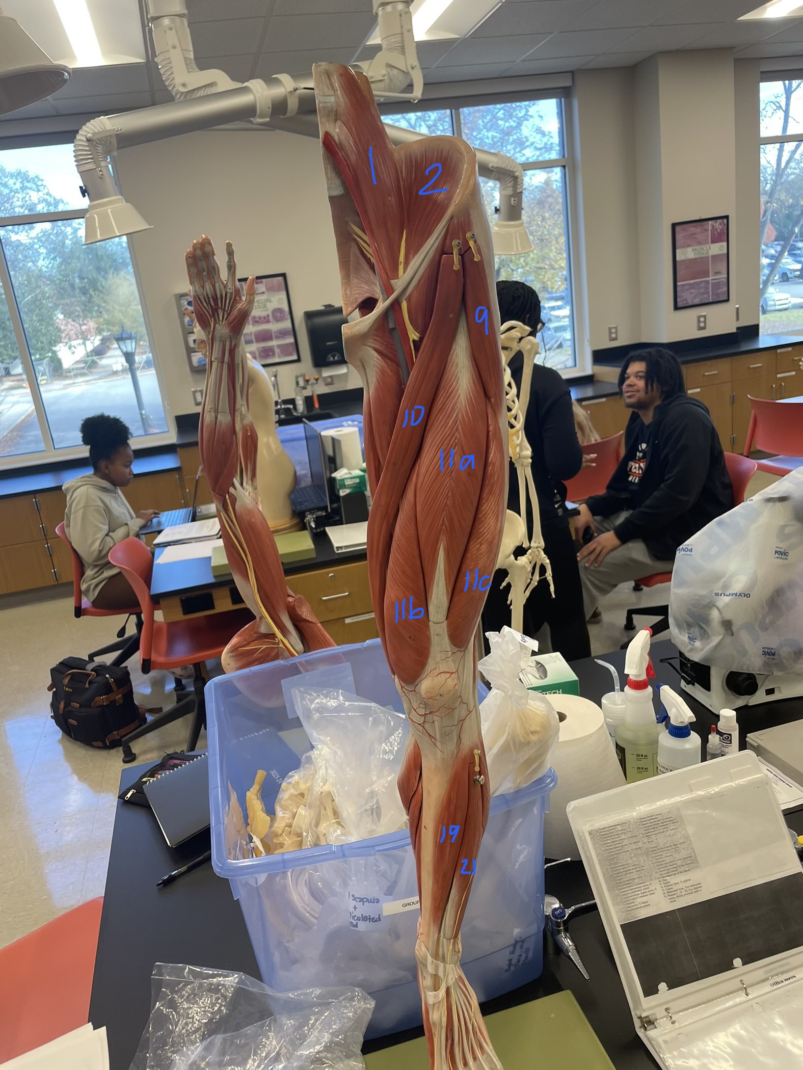 <p>what lowerlimb muscle is #11a</p>