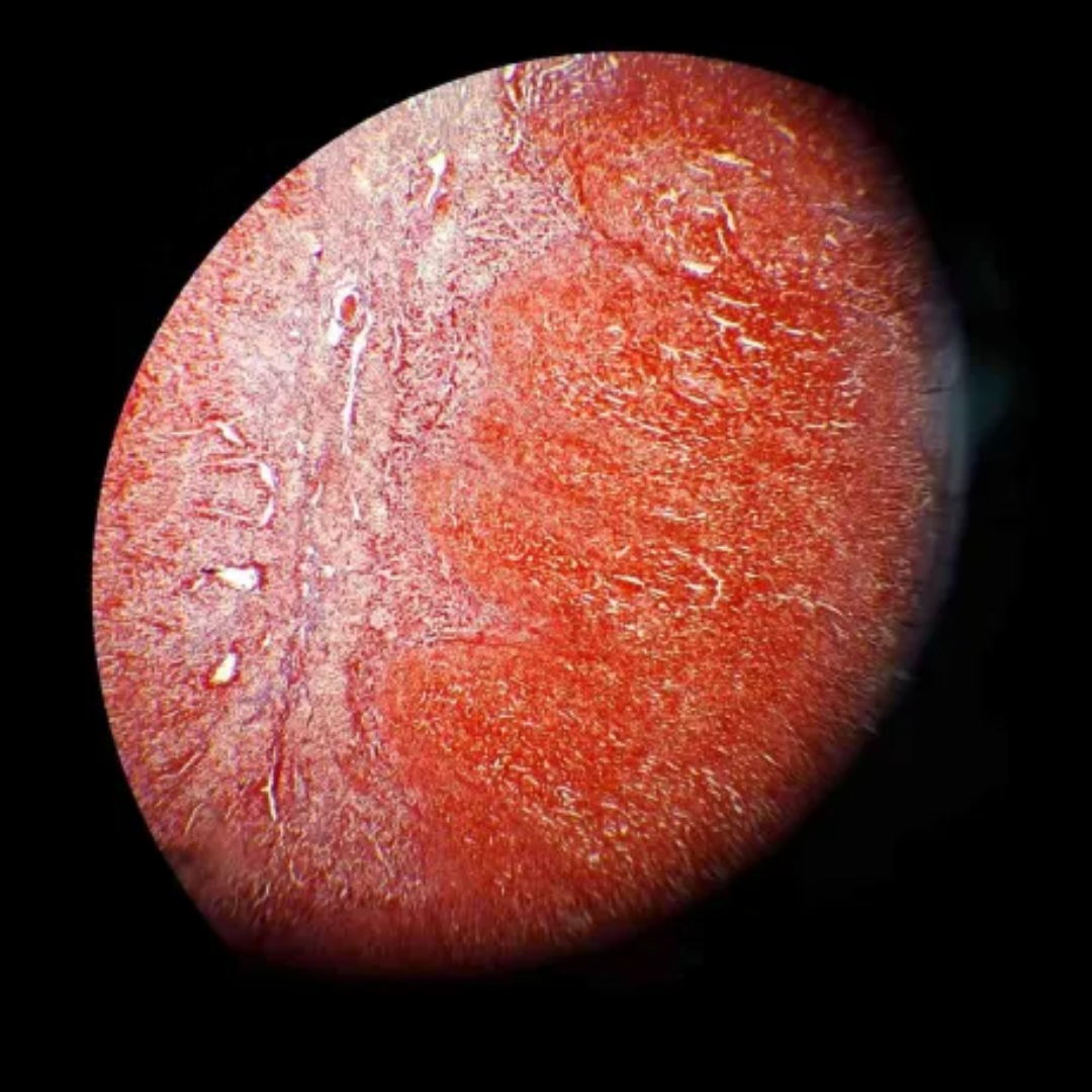 term image