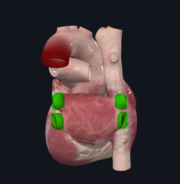 <p>las cuatro llegan a la aurícula izquierda</p><ul><li><p>De color rojo</p></li><li><p>Sangre más oxigenada y limpia del cuerpo</p></li><li><p>Vienen del pulmón, sangre recién oxigenada</p></li></ul><p></p>