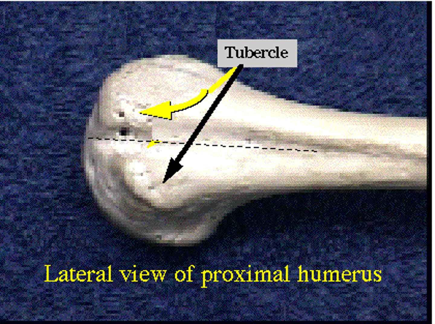 <p>Name the Ligament/tendon projection: </p>