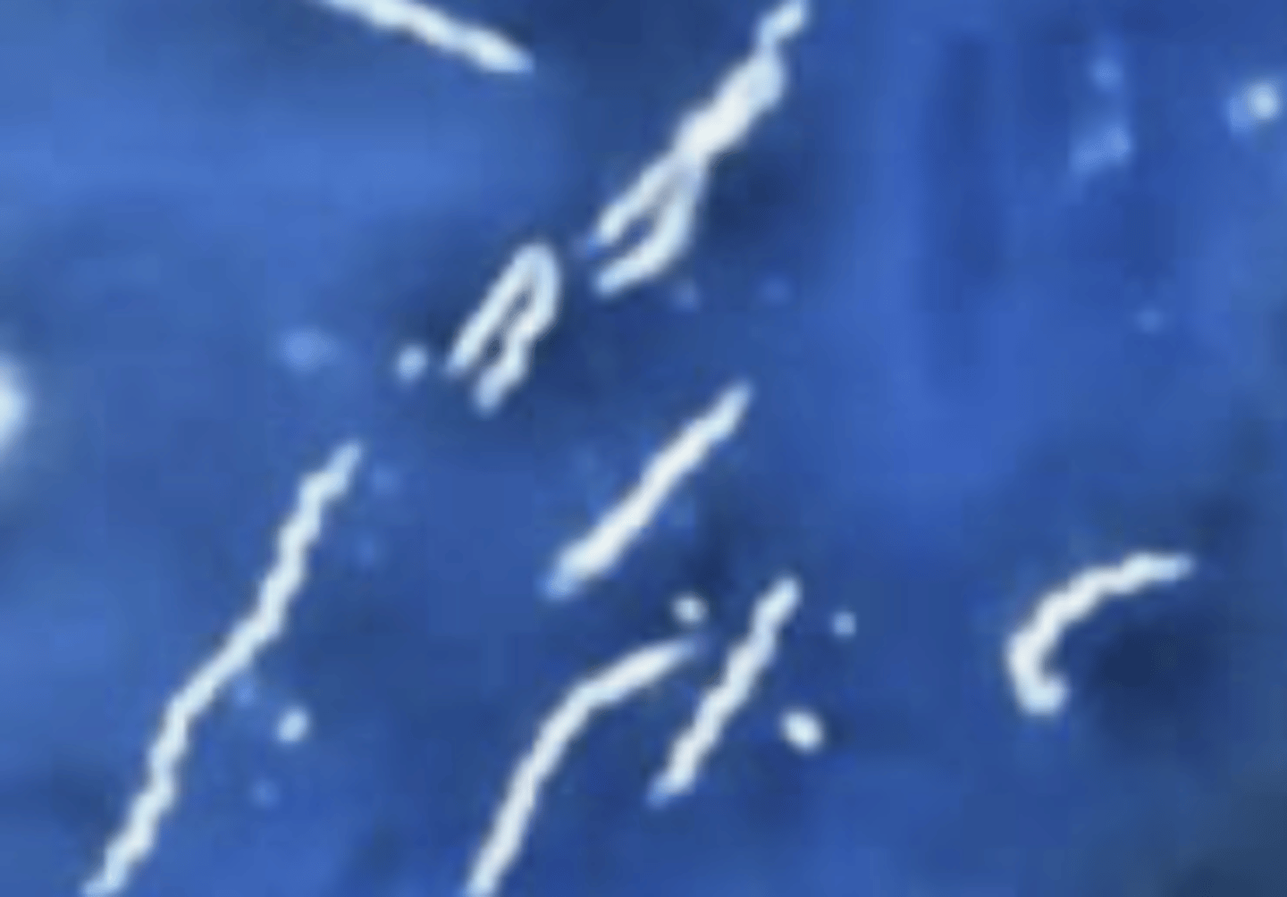 <p>Identify the bacteria's shape.</p>