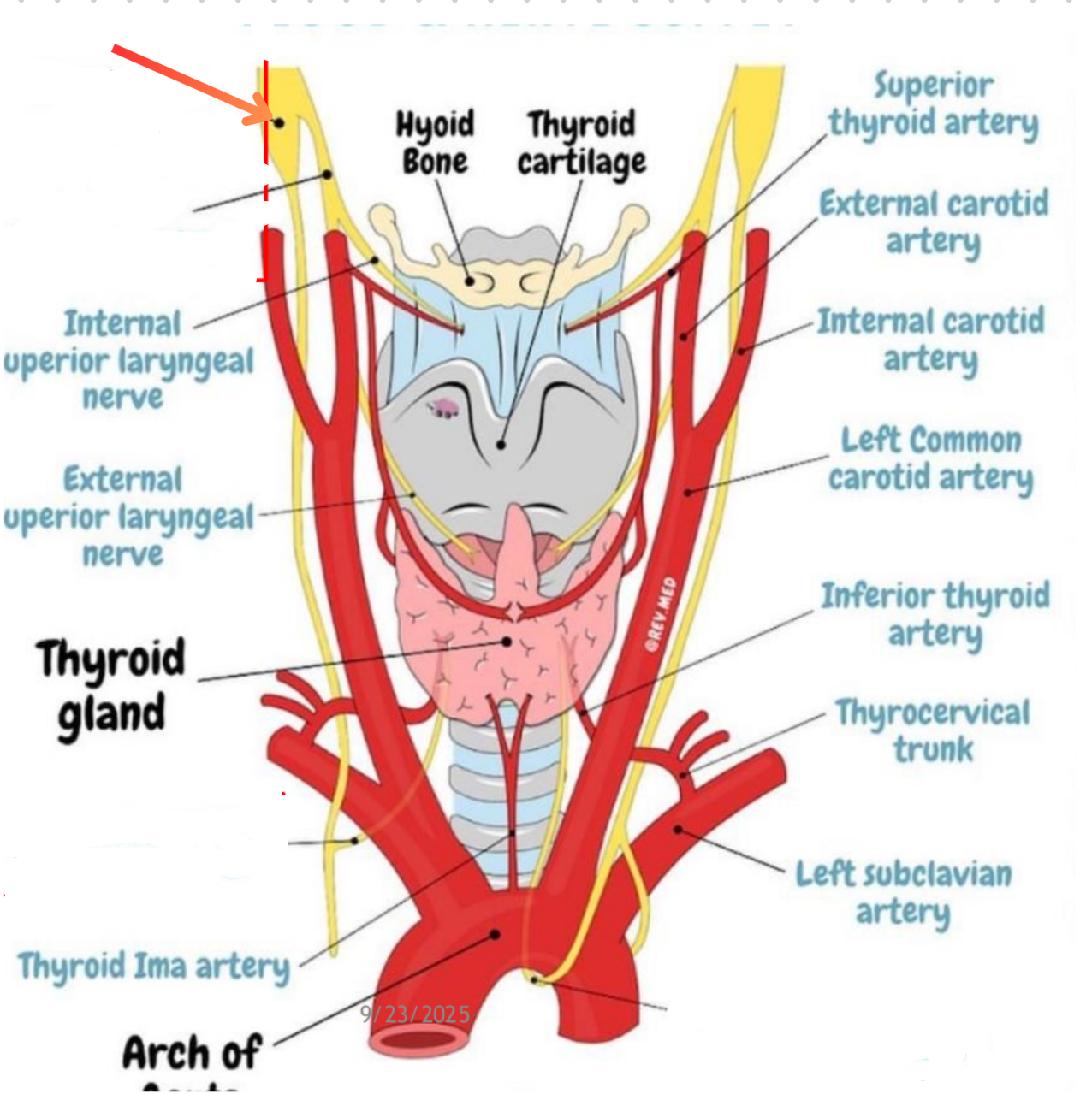 term image