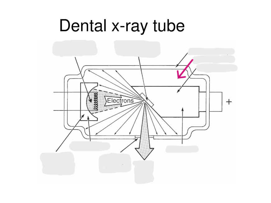<p>A sealed environment within the X-ray tube where air is removed to prevent electron collisions, allowing for efficient X-ray production</p>
