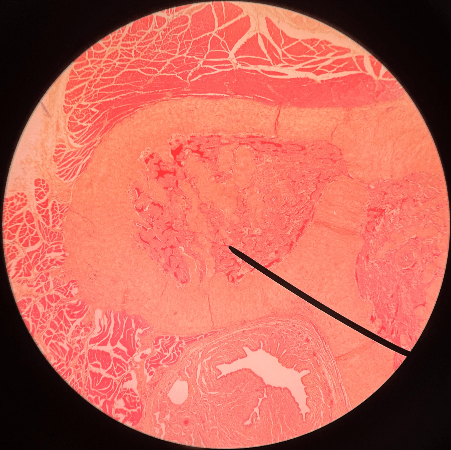 • Slide histology of a c.s. of the penis.

• A cylinder of erectile tissue found on either side of the posterior side of the penis.