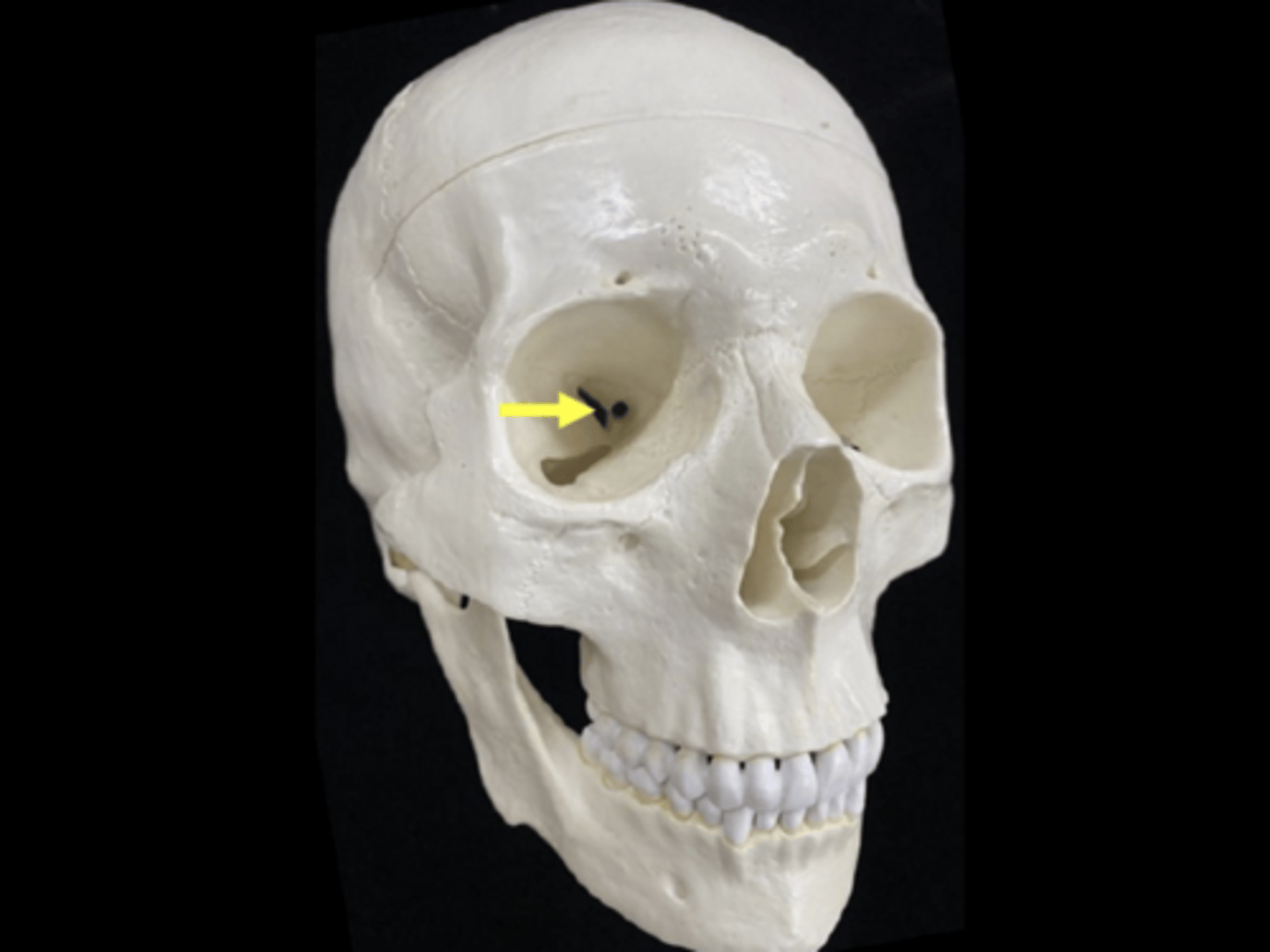 <p>name the bone and bone feature</p>