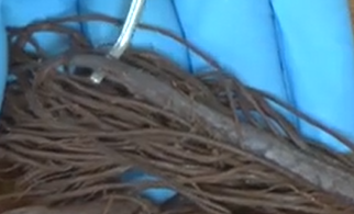 <p>The termination point of the spinal cord.</p>