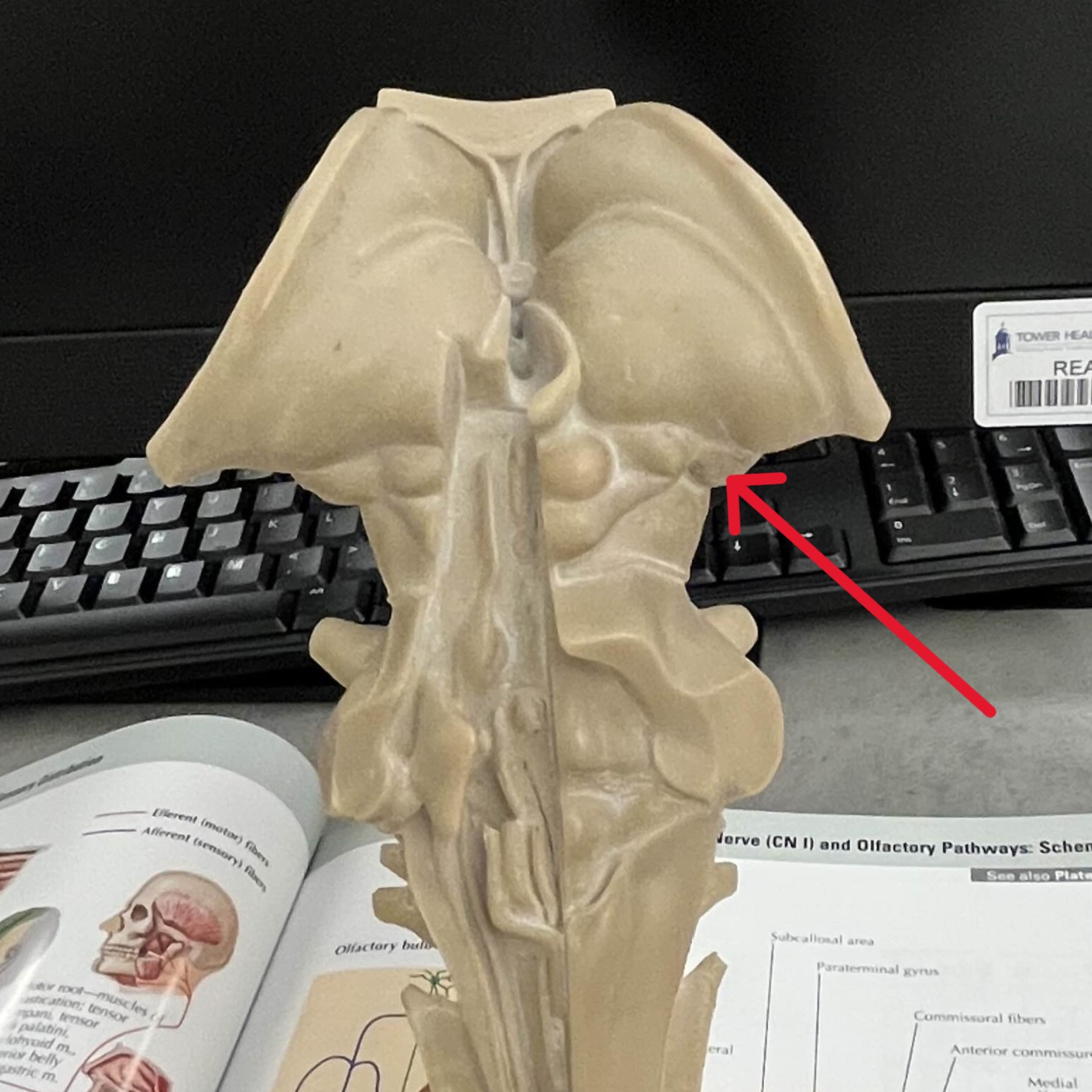 <p>Which part of the thalamus is:</p><ul><li><p>Posterior portion</p></li><li><p>Lateral to medial geniculate</p></li></ul><p></p>