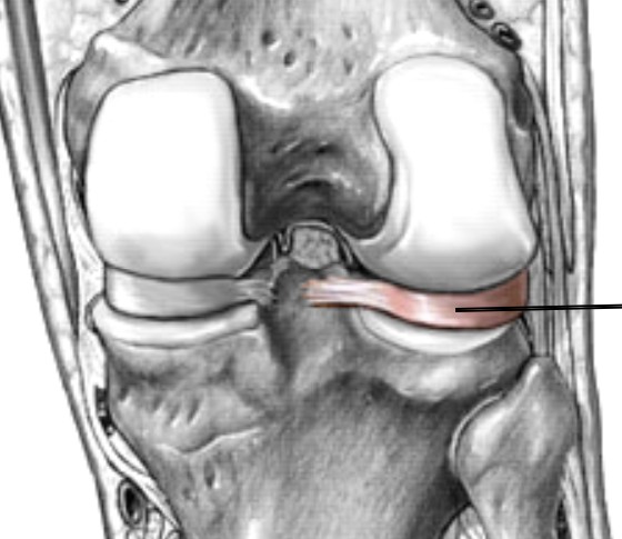 <p>Which part of the knee is a large pad that sits between the femur and tibia on the lateral side?</p>