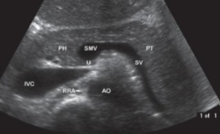 <p>The ‘U’ in this image stands for what?</p>