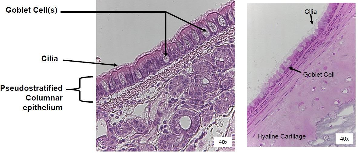 <p>1- Goblet Cells</p><p>2- Cillia</p><p>3- Pseudostratified ciliated columnar epithelium</p><p>Location : Trachea</p><p></p>