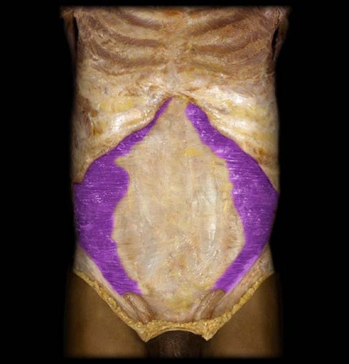 <p>What is this?</p>