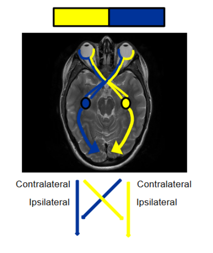 <p>sagittal plane is cut through the body into left and right&nbsp;</p><p>coronal is ct into the body front and back&nbsp;</p><p>transverse is middle&nbsp;</p><p>ipsilateral is same side contralateral is opposite&nbsp;</p>