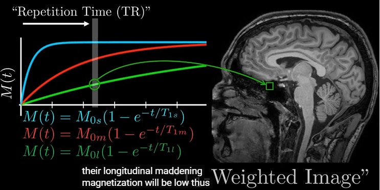 <p>using repetition time to detect signal of tissues based on time to realign with magnetic field</p><p>tissues with long T1 - spins won’t have realigned with field, longitudinal magnetisation will be low → dark</p><p>tissues realigning quickly have more magnetisation → bright</p>