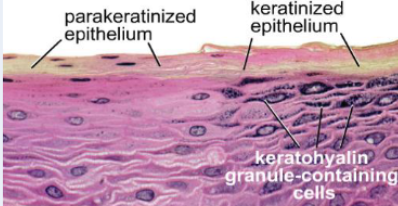 <p>What are perakeratinized cells?</p>