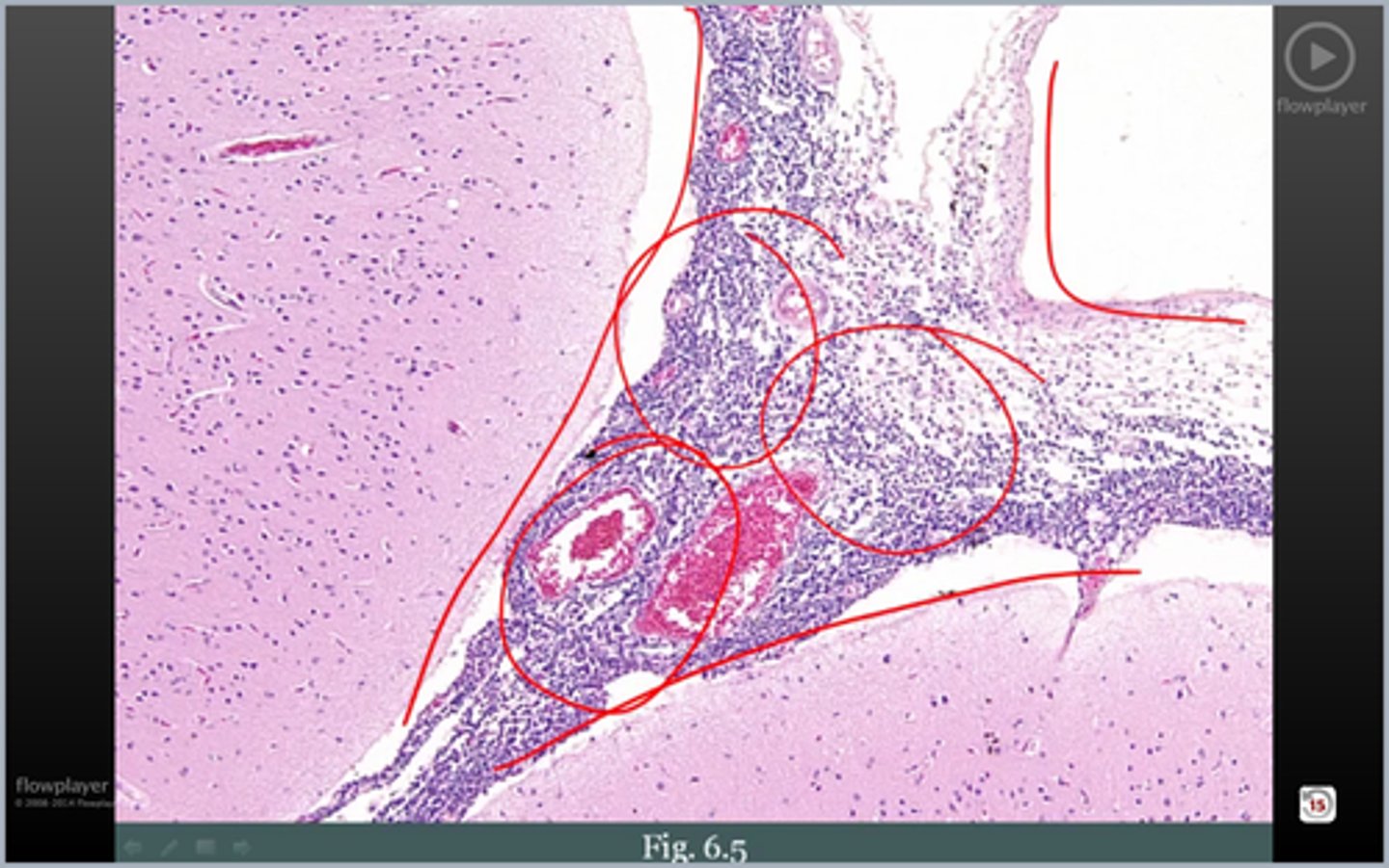 <p>meninges of child</p>
