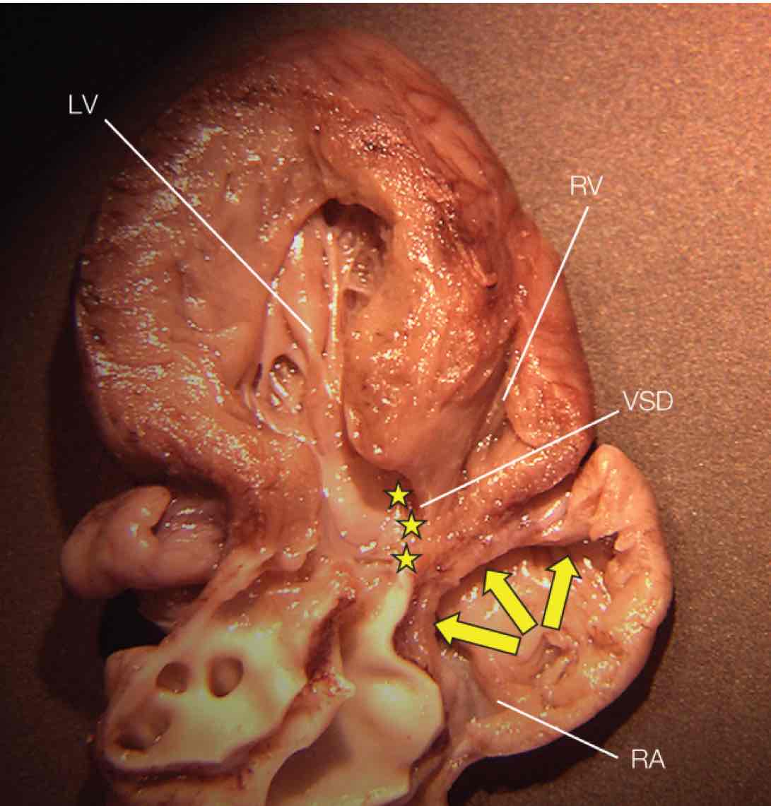 term image