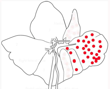 <p>Describe this distribution</p>