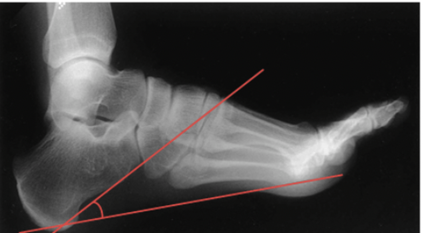 <p>What structure is highlighted?</p>