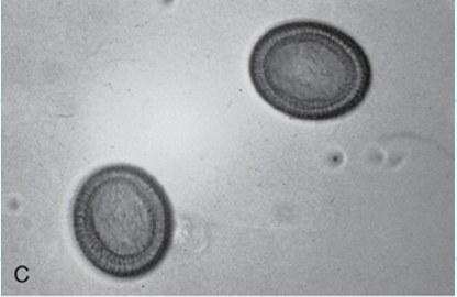 <p>What type egg?</p>