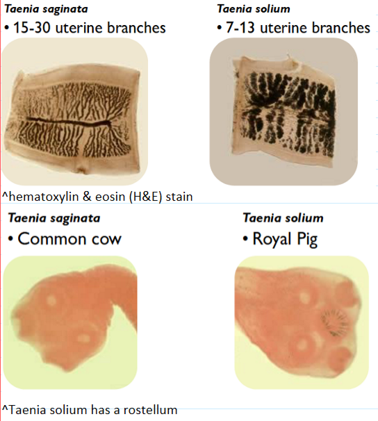 <ul><li><p>T solium (pigs)</p><ul><li><p>7-13 uterine branches</p></li><li><p>“royal pig”—crown looking rostellum </p></li></ul></li><li><p>T saginata (cow)</p><ul><li><p>15-30 uterine branches</p></li><li><p>no rostellum—”common cow”</p></li></ul></li></ul><p></p>