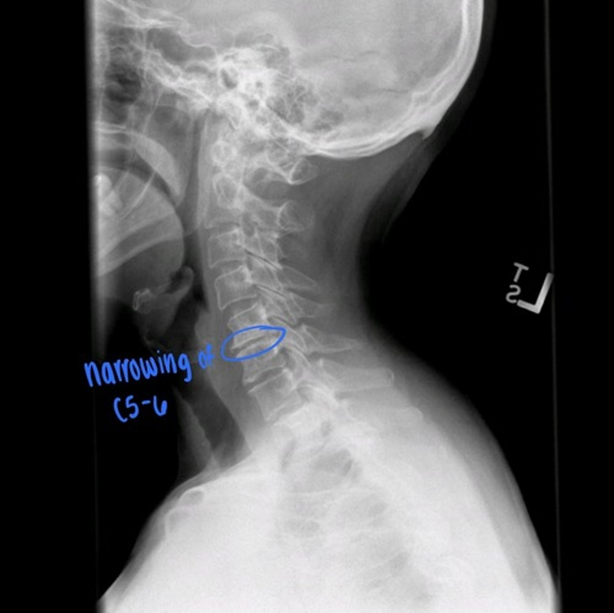 <p>what is the blue circle indicating?</p>