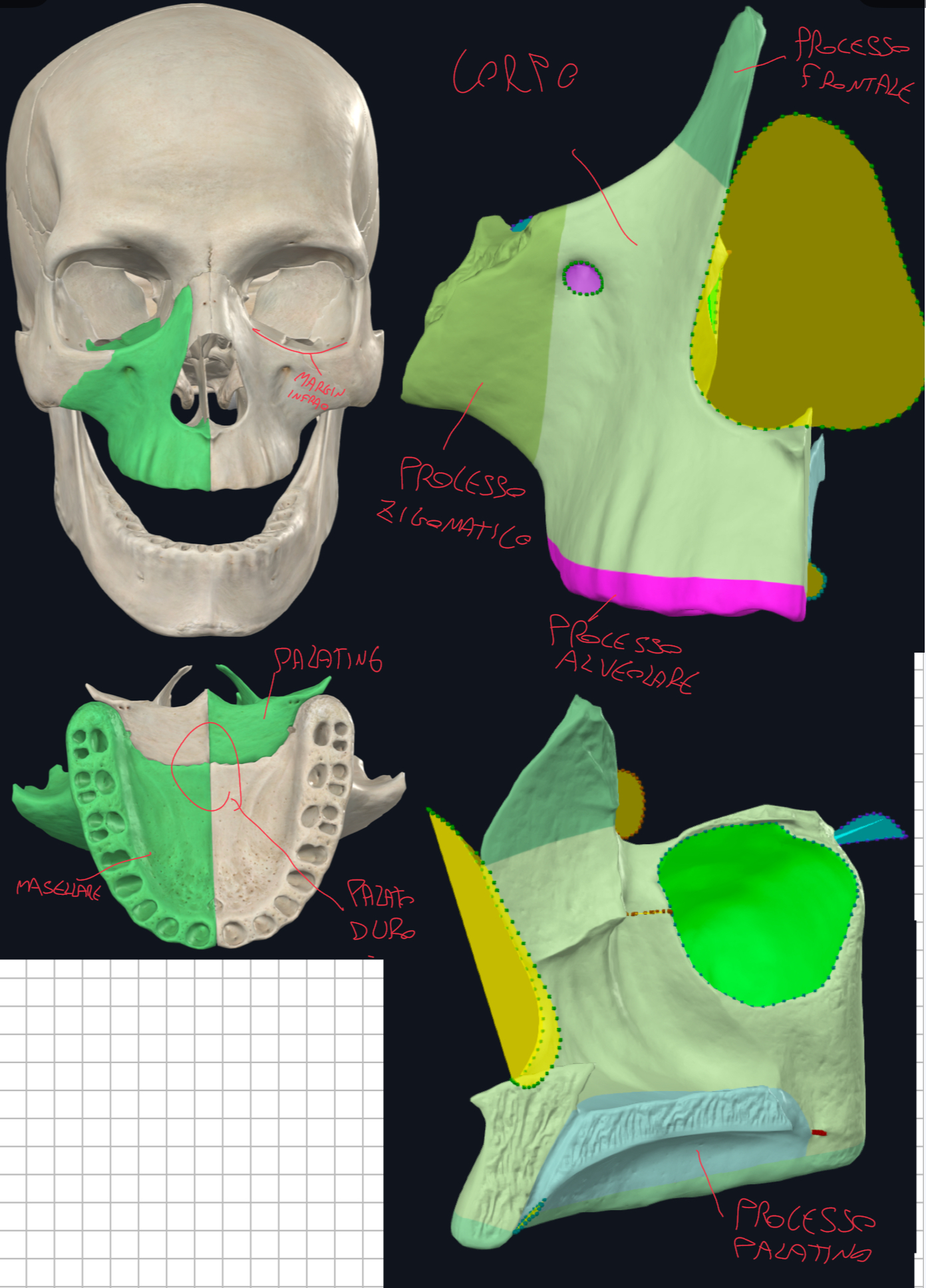 <p>E’ un osso pneumatico che contiene una cavità chiamata Seno Mascellare:</p><ul><li><p>La sua apertura si chiama orifizio del seno mascellare, che si trova sulla faccia mediale e rappresenta anche la parete laterale della cavità nasale</p></li><li><p>Questa apertura nel vivente è più ristretta per la presenza di mucosa e ossa circostanti.</p></li></ul><p>Dal corpo si dipartono 4 processi:</p><ul><li><p>Processo Frontale → Superiormente → si articola con processo nasale e mascellare dell’Osso Frontale e Ossa Nasali → forma parte della parete laterale della cavità nasale e parte del margine orbitario</p></li><li><p>Processo Zigomatico → Lateralmente → si articola con il processo mascellare dell’Osso Zigomatico formando la sutura zigomatico-mascellare</p></li><li><p>Processo Palatino → Medialmente → forma la parte anteriore del palato duro, completato con le Ossa Palatine</p></li><li><p>Processo Alveolare → Inferiormente → contiene gli alveoli dentali dell’arcata superiore (8 denti)</p></li></ul><p></p>