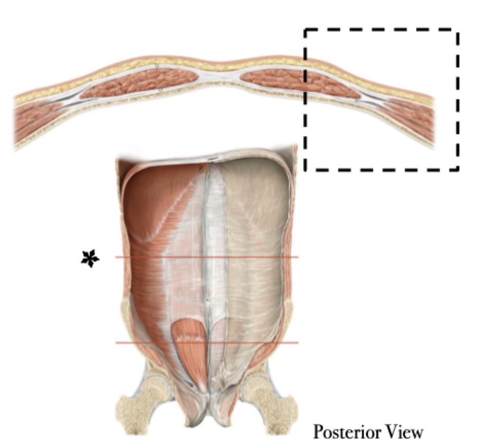 <p>Rectus Sheathe <u>above</u> the arcuate line</p>