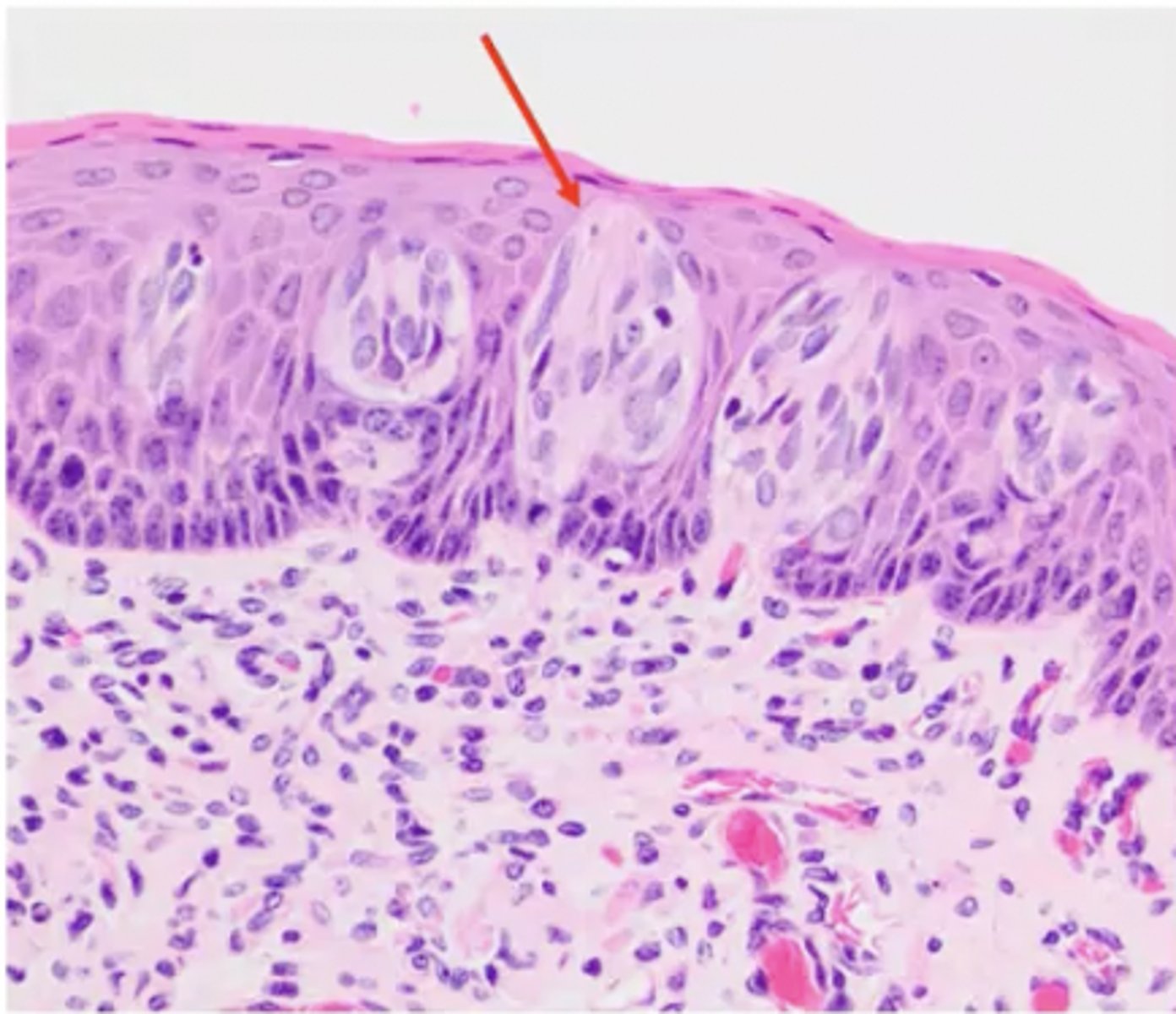 <p>What structure is this epithelium found in?</p>