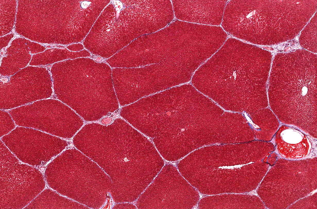 <p>An accessory organ of digestion</p>