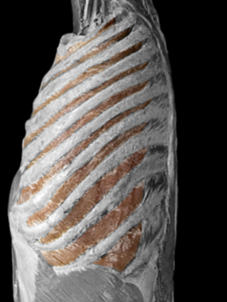 <p>What is this muscle?</p>