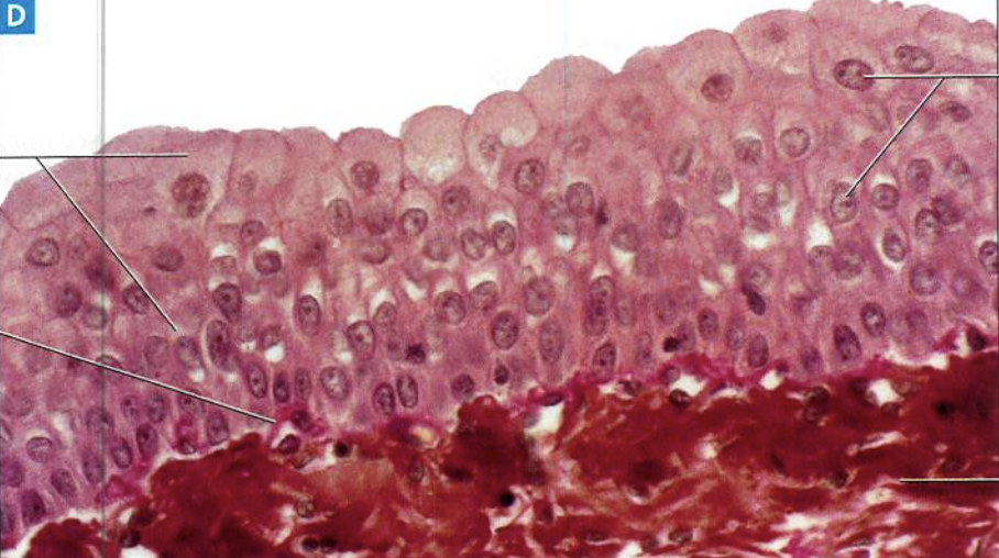 <p>What type of tissue is present in this image?</p>