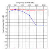 <p>What paitient is this? what treatment method do they need?</p>