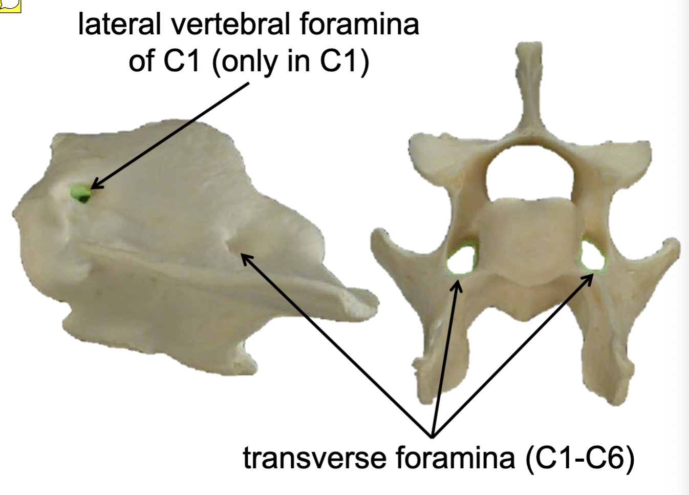 <p>Lateral vertebral foramina of C1 (only in C1)</p>