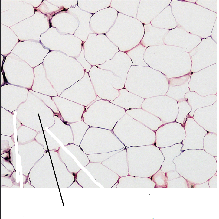 <p>What part of the connective tissue is this?</p>
