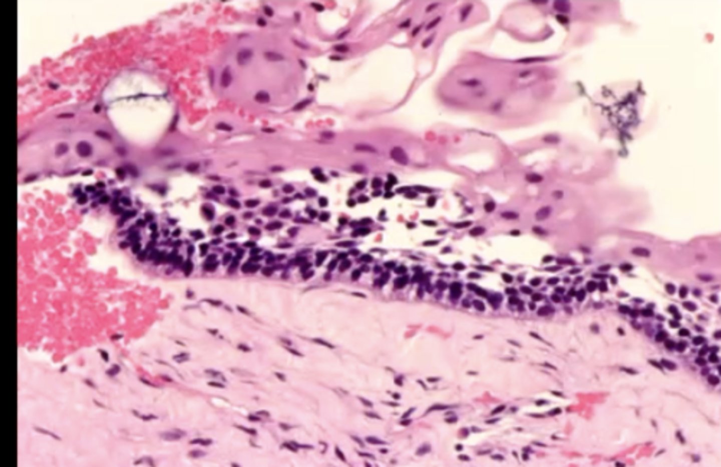 <p>1. stellate reticulum</p><p>2. columnar ameloblasts with polarized nuclei toward stellate reticulum</p><p>3. apical clearing of cytoplasm</p>