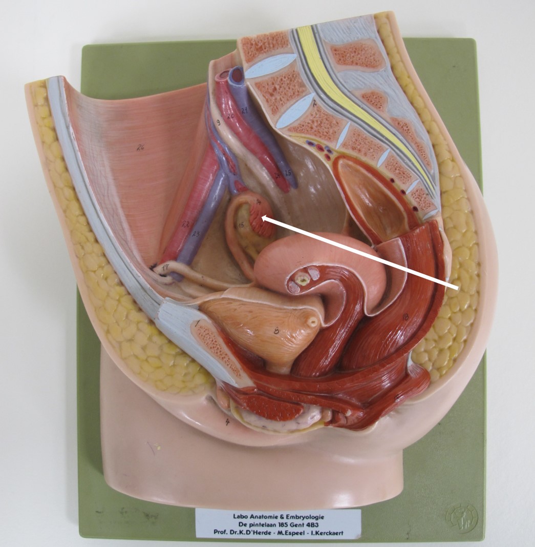 <p>deel tuba uterina</p>