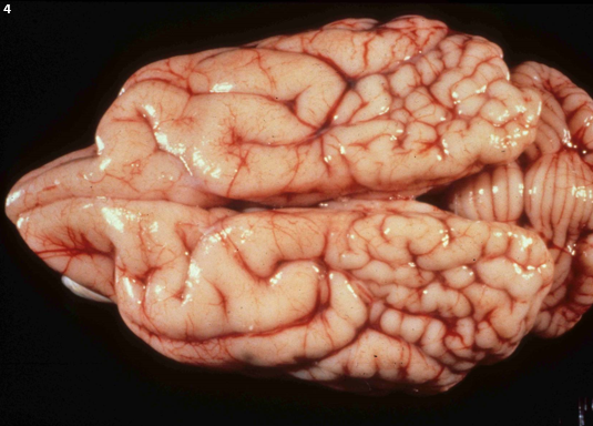 <p>4.<span>&nbsp; </span>Tissue from a dog.<span>&nbsp; </span>Which of the following is correct?<span>&nbsp;&nbsp;&nbsp;</span></p><ol type="a"><li><p>Ulegyria; seen in Pugs</p></li><li><p>Pachygyria; seen in Bull Mastiffs</p></li><li><p>Cortical dysplasia; seen in Collies and Shelties</p></li><li><p>Polymicrogyria; <span>&nbsp;</span>seen in Standard Poodles.</p></li></ol><p></p>