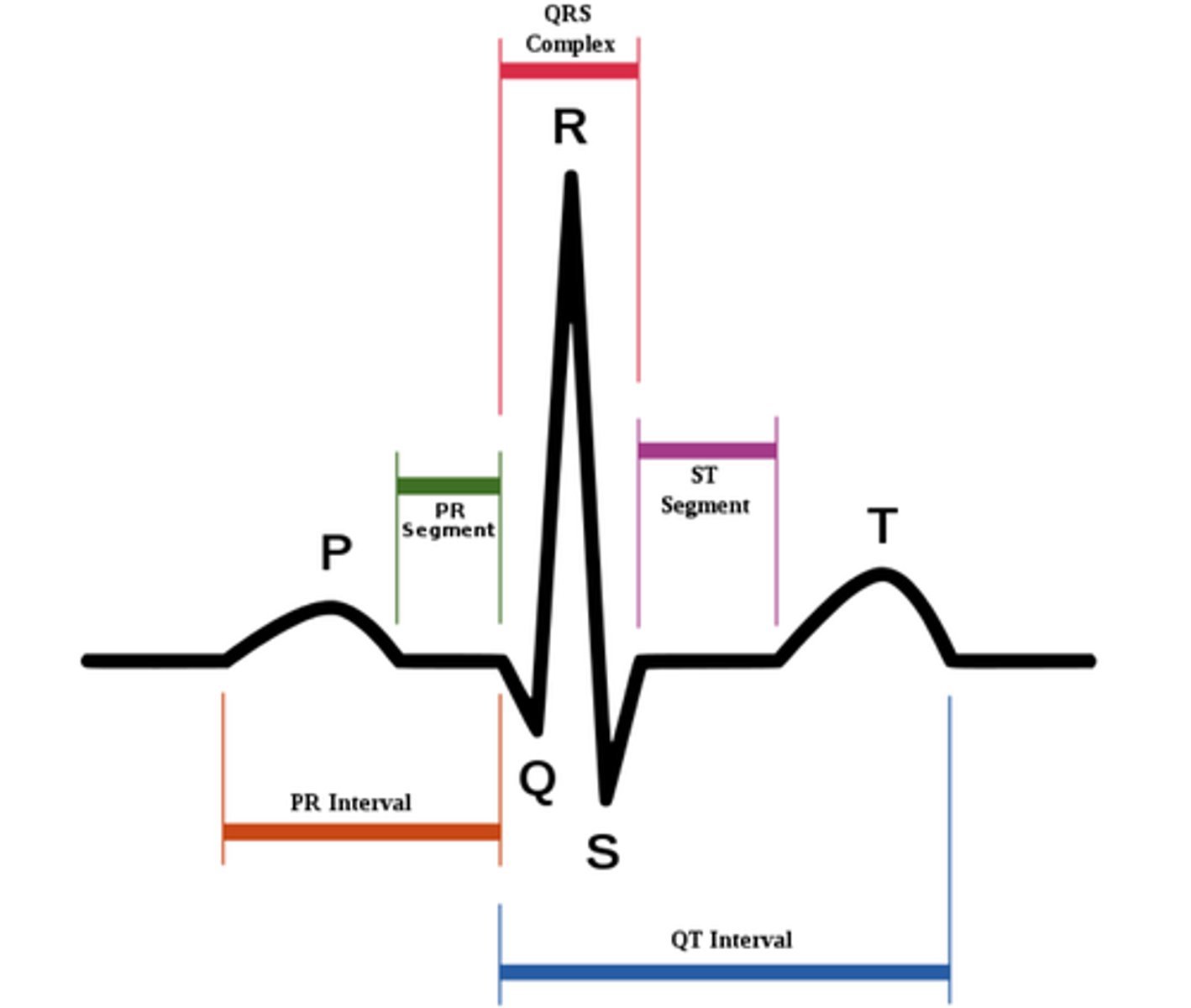 <p>On the EKG tracing, what wave occurs first as a result of ventricular depolarization AND atrial repolarization?</p>